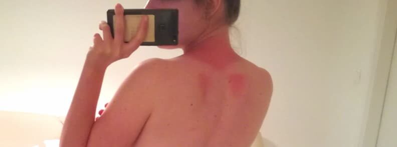 mirela the travel bunny sunburns athens 旅行兔子米雷拉晒伤了雅江南娱乐最新网站下载地址典